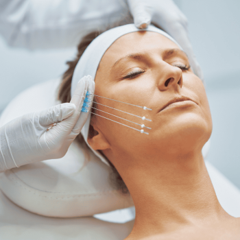 Fio de Sustentação Facial